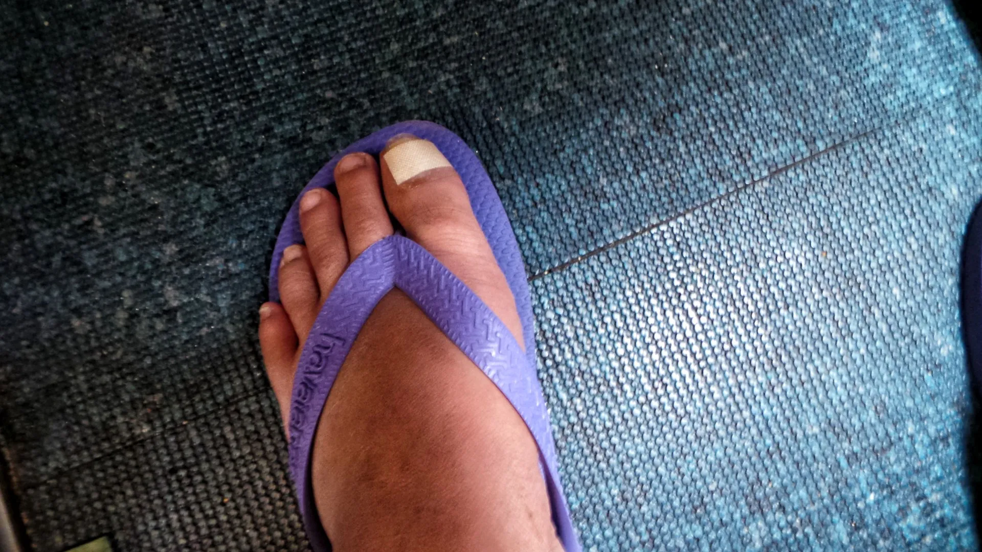 A dead toenail and a story to tell.